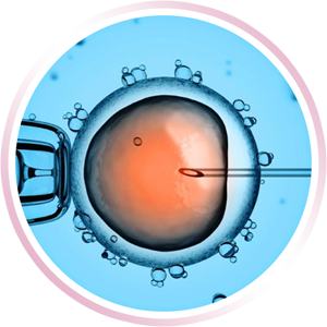 Fecundación In Vitro