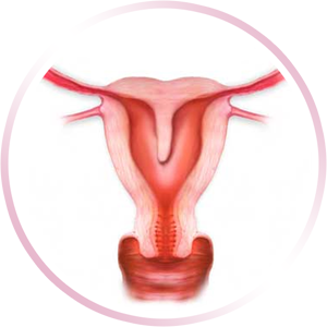 Malformaciones Uterinas