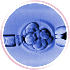 Hatching Asistido